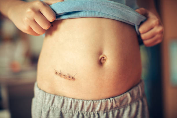 best doctor for appendix in virar