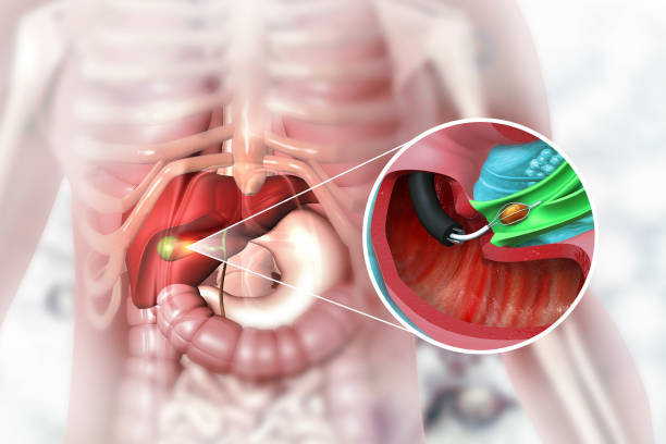 gallbladder removal treatment in virar