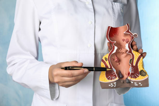 best piles specialist doctor in virar